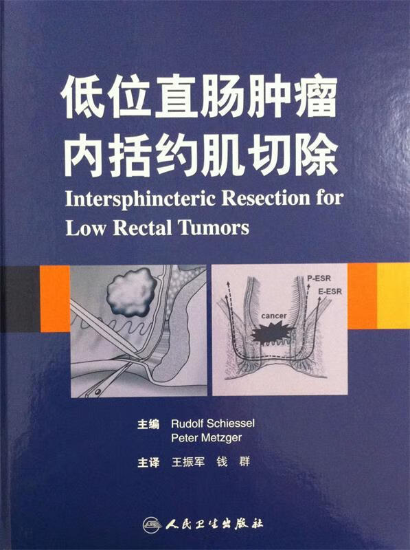 低位直肠肿瘤内括约肌切除
