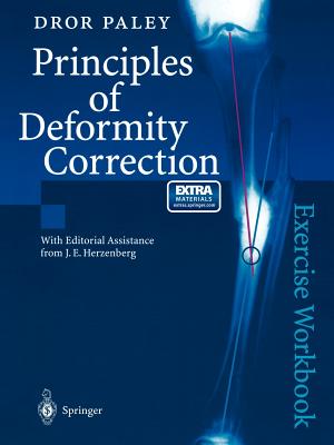 预订 principles of deformity correction