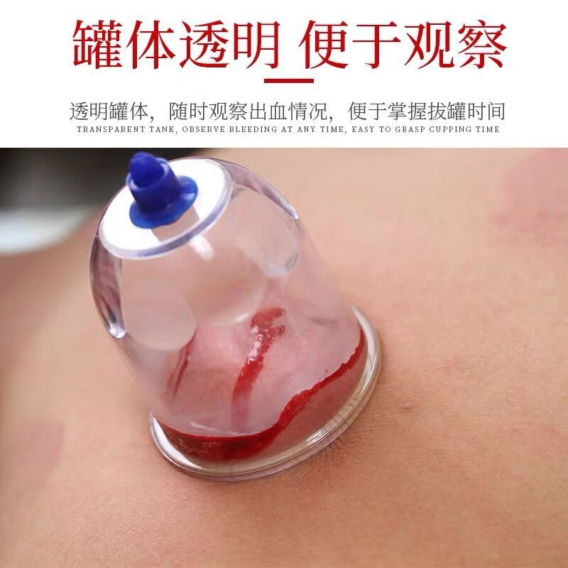 心天泻血真空拔罐器家用套装拔血罐采血刺血放血针排瘀大号罐 泻血罐