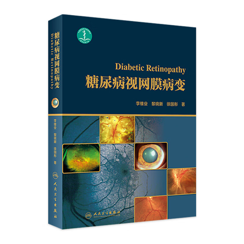 糖尿病视网膜病变