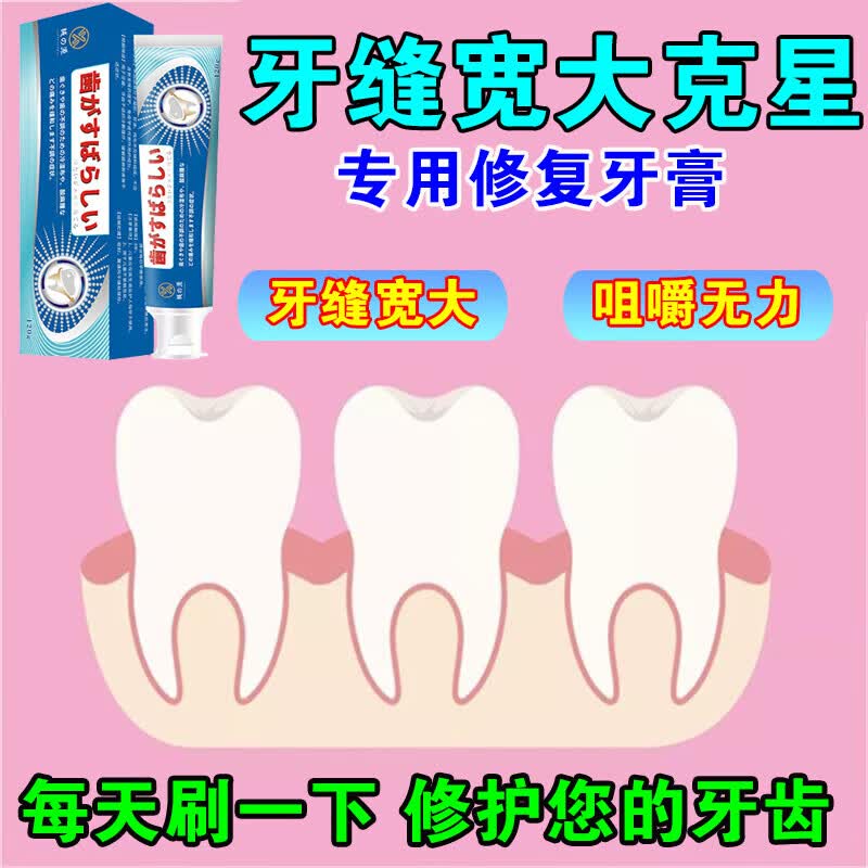 【官方直售】牙缝宽大牙洞填充剂修复牙齿漏风牙龈1萎缩专用修补填充