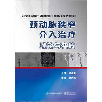 颈动脉狭窄介入治疗:理论与实践