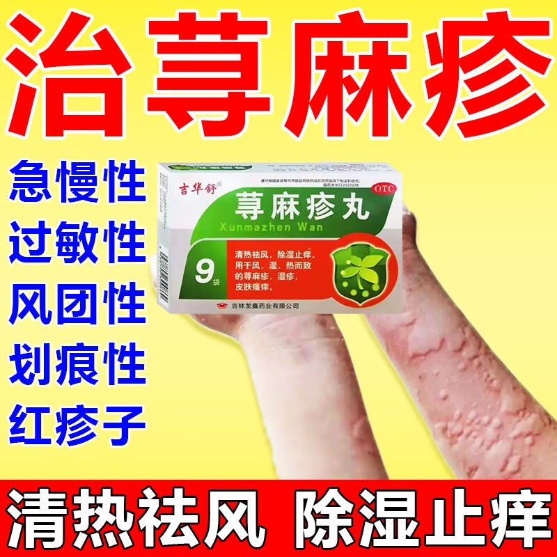 瘙痒清热祛风除湿止痒全身过敏红疹红肿荨麻疹吃什么药风团荨麻疹药品