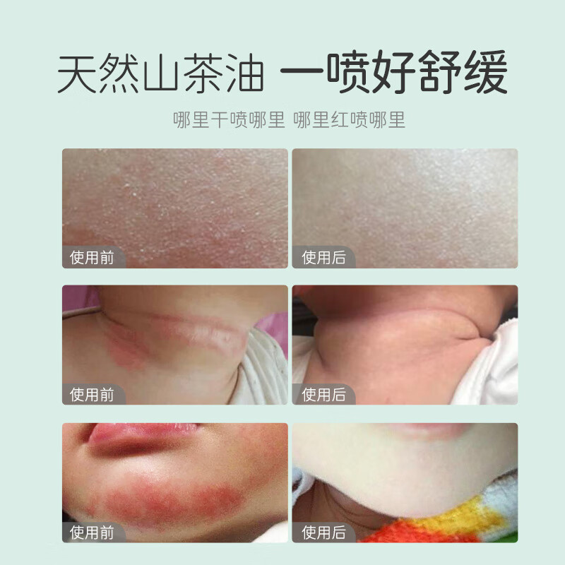 松达婴儿山茶油宝宝护肤油新生儿抚触油按摩油保湿润肤滋润护臀油 【一瓶多效】山茶油50ml