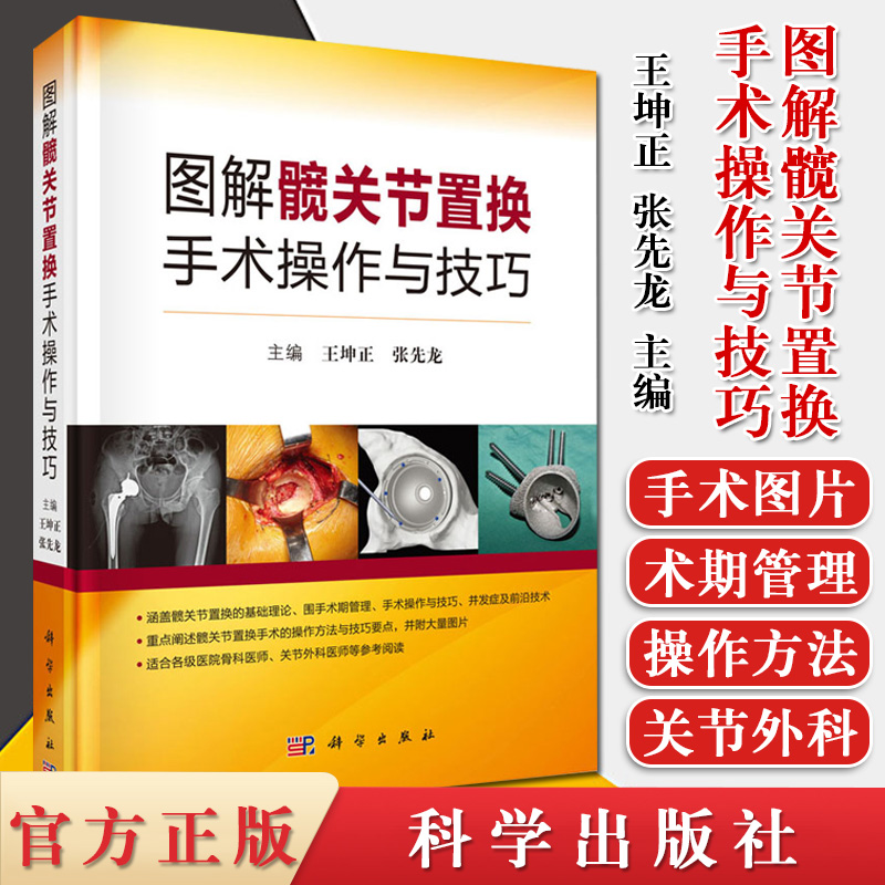 图解髋关节置换手术操作与技巧 王坤正 张先龙主编 髋关节基础理论手术技巧 临床医学 科学出版社