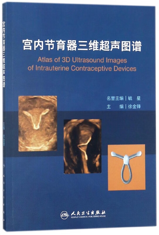 宫内节育器三维超声图谱