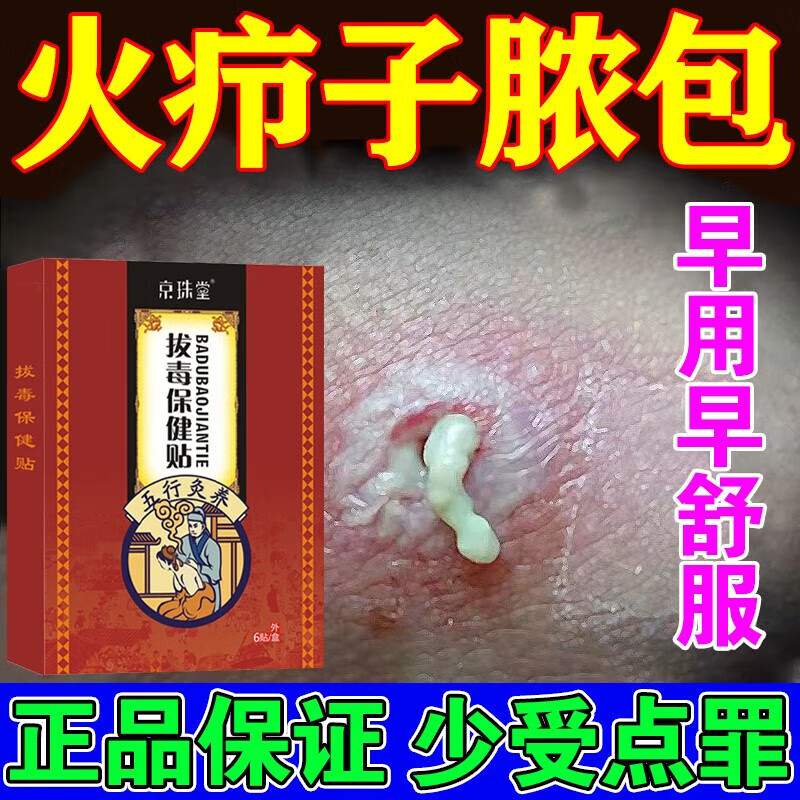 火疖子拔毒i膏贴大包去脓包痘痘红肿硬块坐疮皮脂腺囊肿化脓排脓膏 单