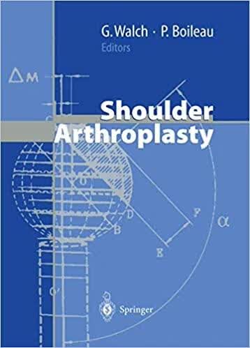 预订Shoulder Arthroplasty