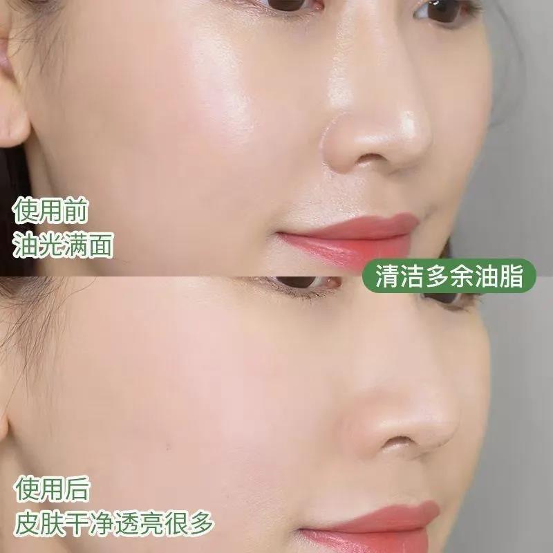 别挤！让毛孔排出脏东西 固体面膜清洁泥膜收缩毛孔男女 固体面膜【绿茶1+茄子1】