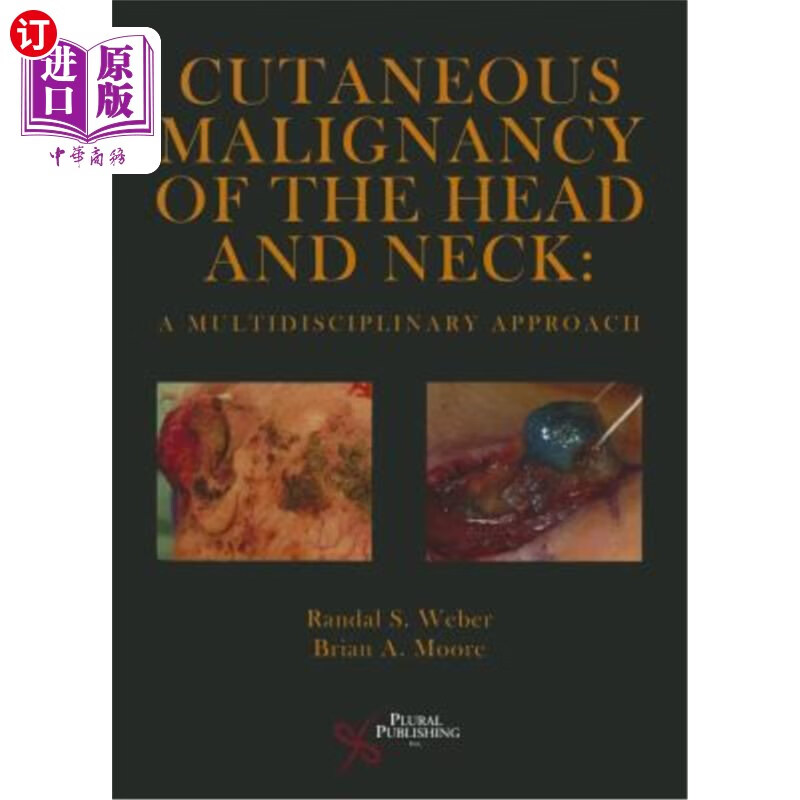 海外直订医药图书cutaneous malignancy of the head and neck: a
