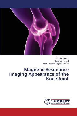 预订Magnetic Resonance Imaging Appearance of the Kne