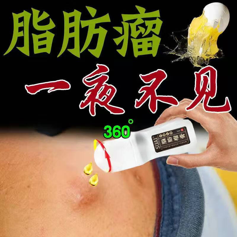 皮下囊肿硬块脂肪瘤克星粉瘤皮脂腺囊肿专用皮脂腺囊肿訷器 1瓶装