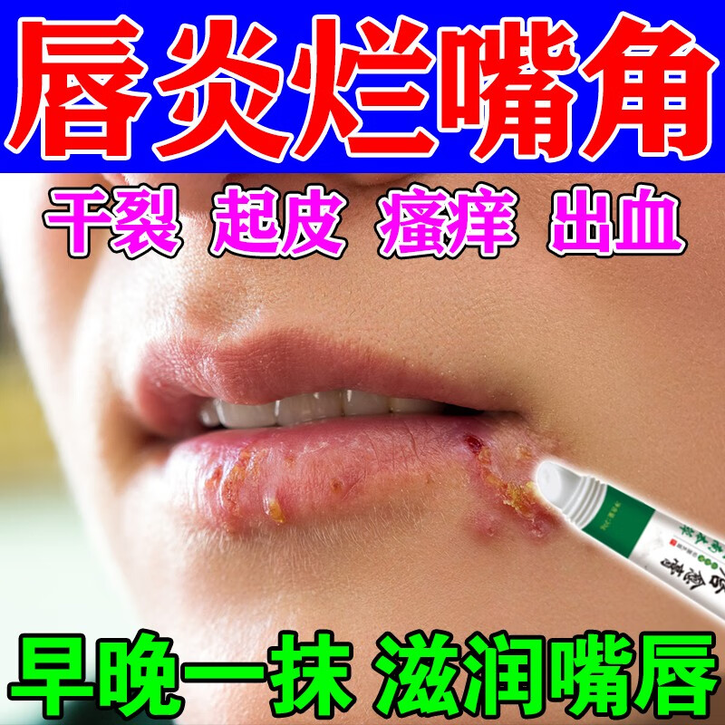 药唇膏(中药唇膏)