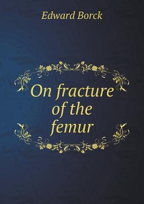 预订On Fracture of the Femur