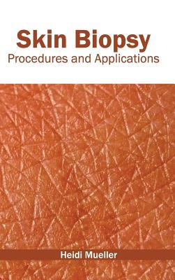 预订Skin Biopsy: Procedures and Applications
