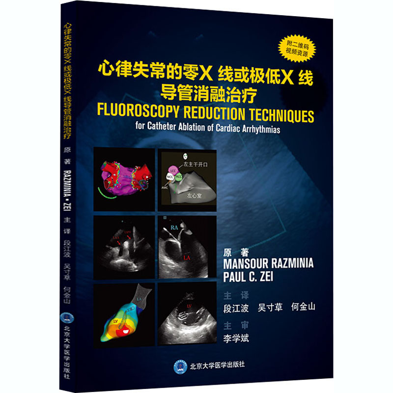 心律失常的零X线或极低X线导管消融治疗