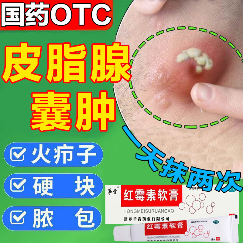 火疖子拔毒药膏 治头部颈部前胸后背脓包痘痘火疖子毒疙瘩结节性粉刺