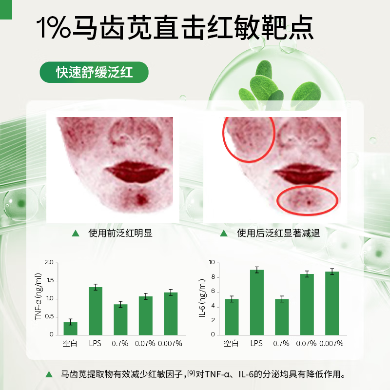 基理基底膜ECM修护霜干敏肌舒缓泛红屏障受损纤连蛋白面霜抗皱油敏霜 【干敏套装】洁面+水+修护霜50g