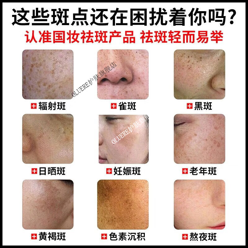 药房直售 蜜肌霜霜去斑点雀斑妊娠斑日晒斑老年 1瓶适用各种斑