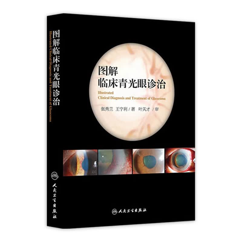 图解临床青光眼诊治