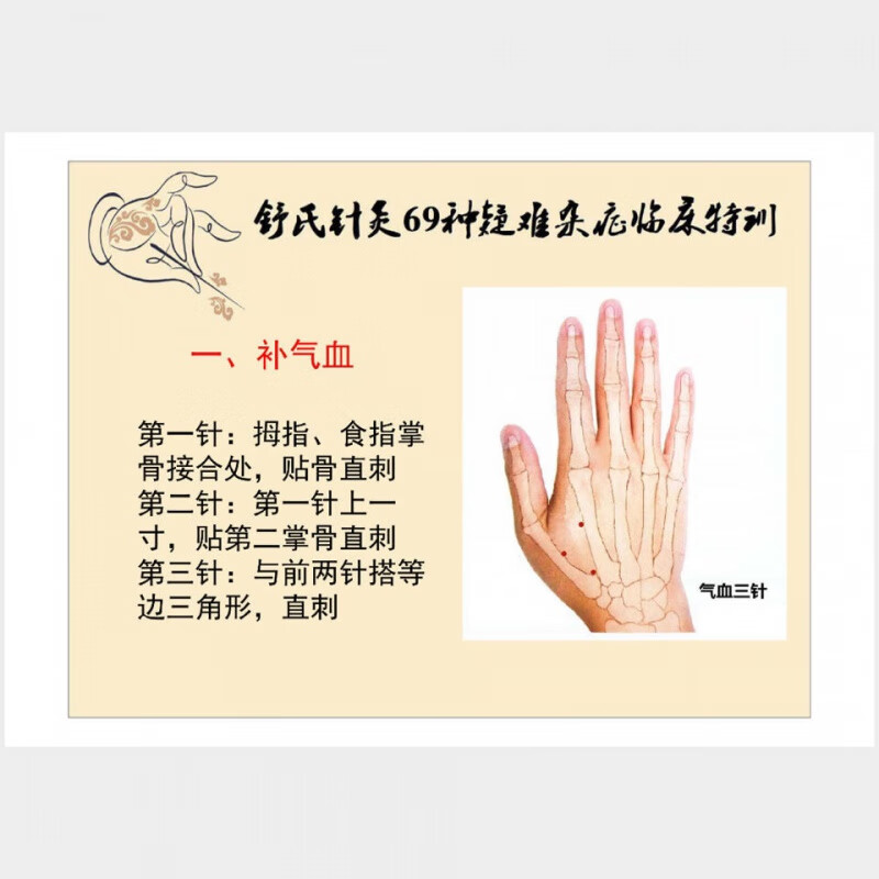 舒氏针灸69种杂证内部资料全彩78页中医针灸实体彩色书