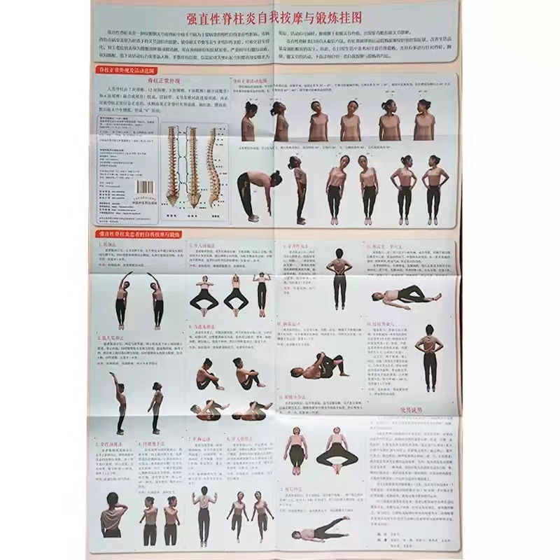 强直性脊柱炎自我按摩与锻炼挂图 郑润杰 张雄 主编 中国中医药出版社 真人演示彩图