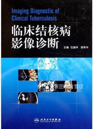 临床结核病影像诊断,伍建林//路希伟,人民卫生出版社,9787117147583