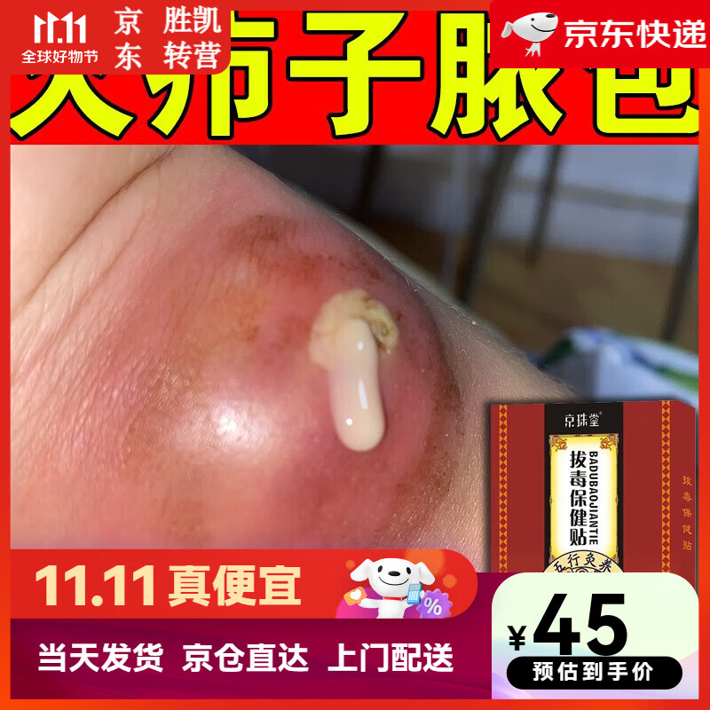 拔毒膏疖子拔脓贴适用于大包脓包身上屁股脓包白色脓头膏贴 单盒装