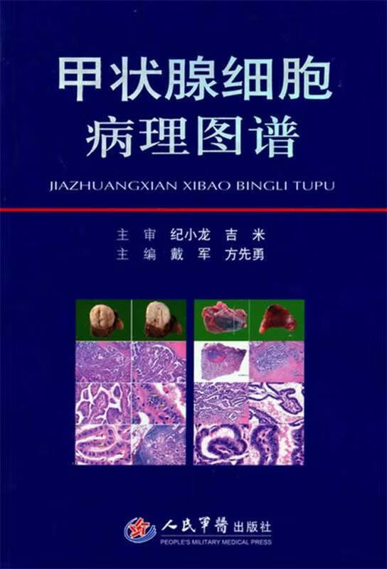 甲状腺细胞病理图谱【好书,下单速发】