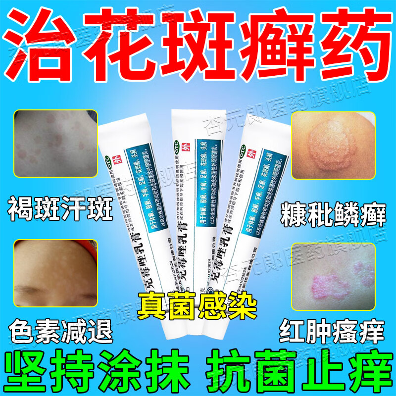 治花斑癣汗斑乳膏外用药 祛汗斑花斑癣体癣白斑花斑糠疹结痂脱屑脸