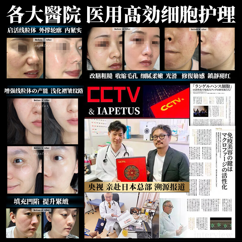 小野拓司爆·RS幹细胞灌肤 1次灌肤=3次全套护肤 瓷白抛光小V脸紧致 1盒初体验 日本每盒598元