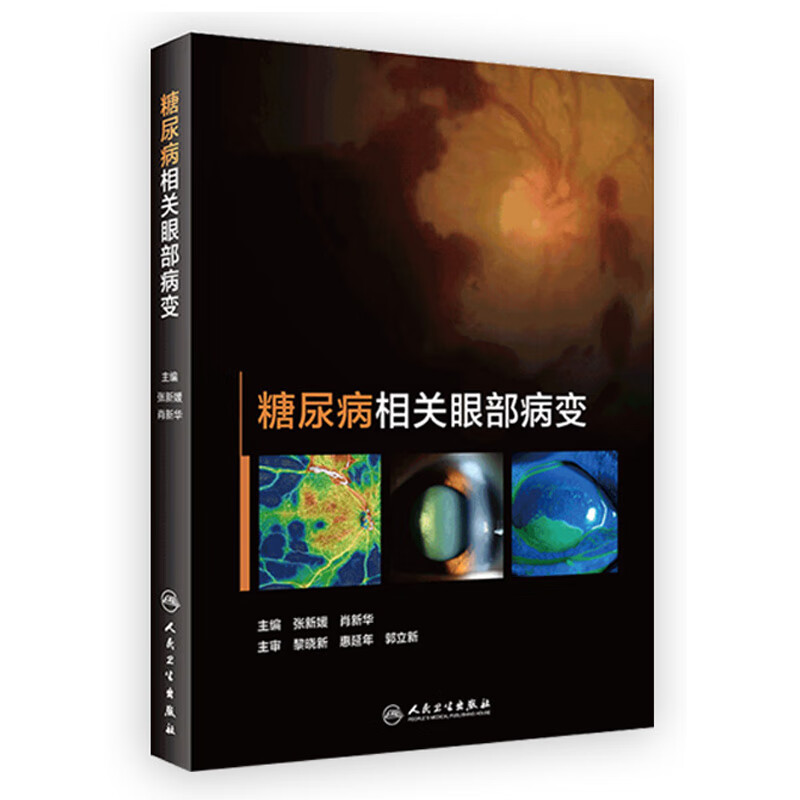 糖尿病相关眼部病变 9787117326308 2022年2月参考书