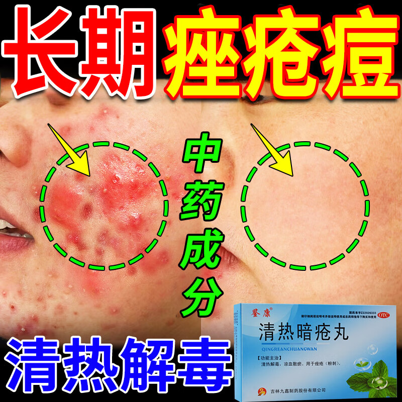 反复长痘痘脓包疮红色丘疹青春痘粉刺背部长痘祛痘口服药清热暗疮丸 3