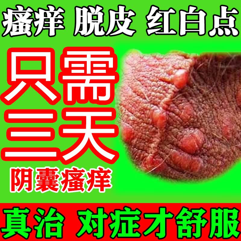 治脱皮干裂瘙痒湿疹止痒私处睾丸痒去潮湿疙瘩异味真菌感染 1盒【建议