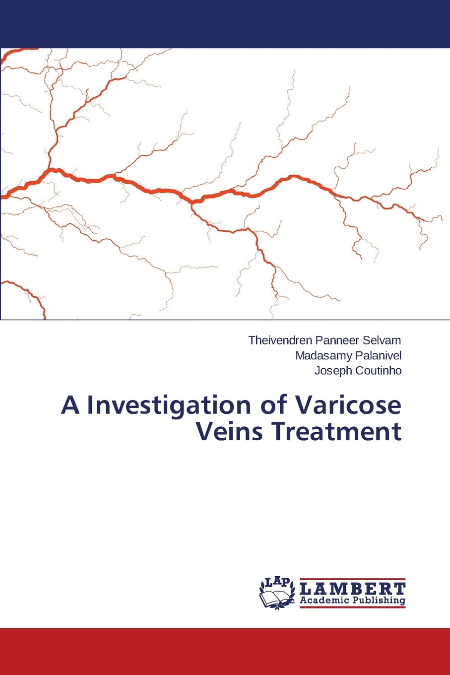 【预售 按需印刷】a investigation of varicose veins treatment