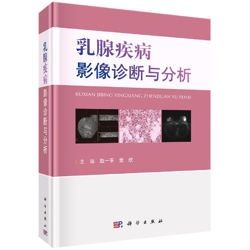 乳腺疾病影像诊断与分析(精)