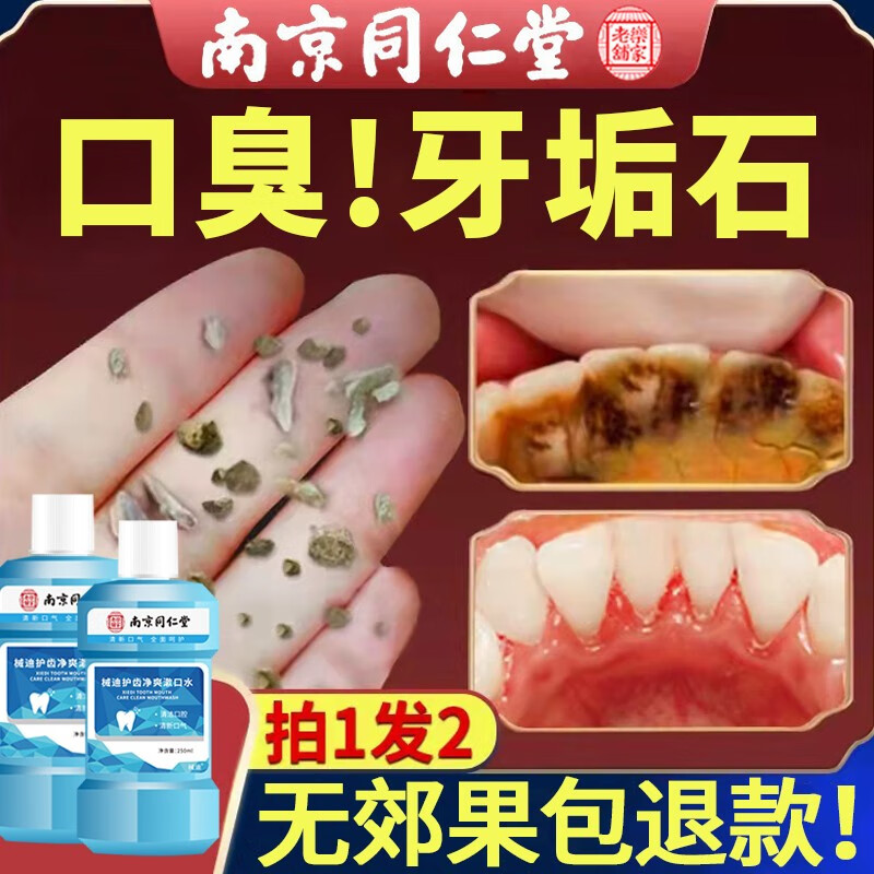 fsyr南京同仁堂漱口水口气臭异味黄牙渍牙垢结口腔清新剂烟石去除 南