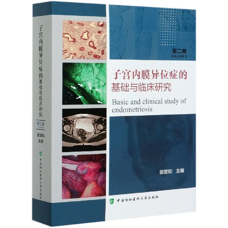 子宫内膜异位症的基础与临床研究(第2卷)