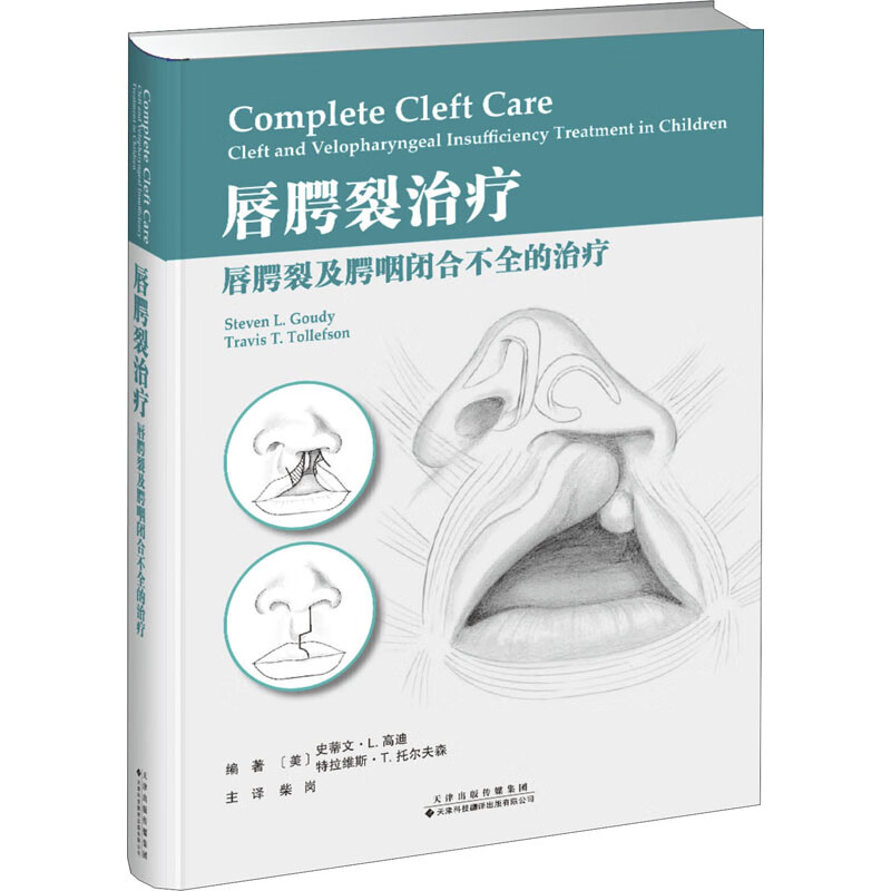 唇腭裂治疗 唇腭裂及腭咽闭合不全的治疗