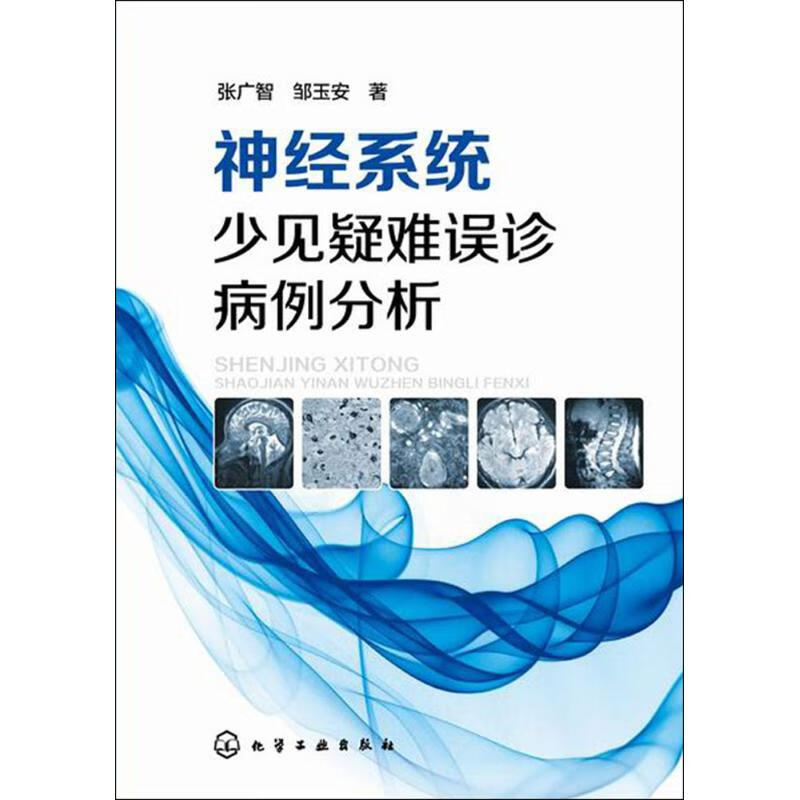 神经系统少见疑难误诊病例分析 张广智,邹玉安 书籍