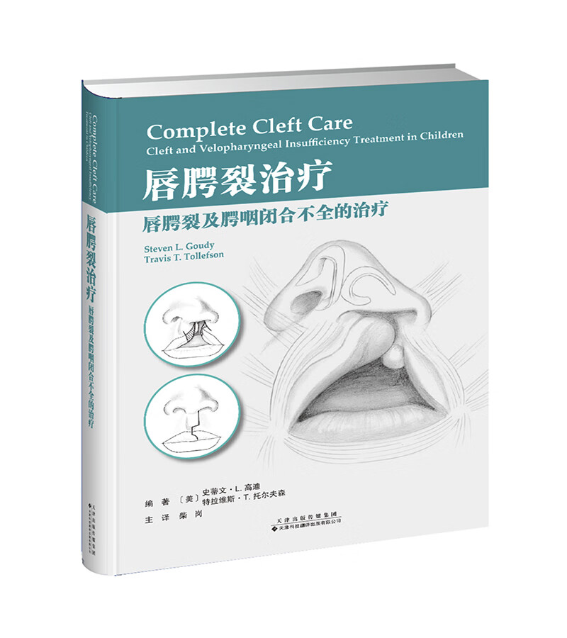 唇腭裂治疗：唇腭裂及腭咽闭合不全的治疗