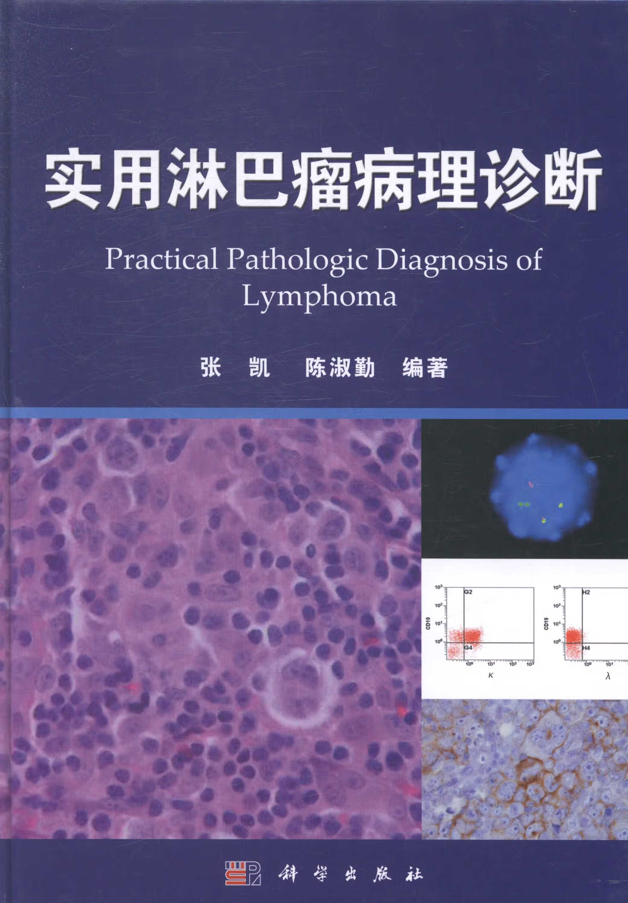 [按需印刷]实用淋巴瘤病理诊断