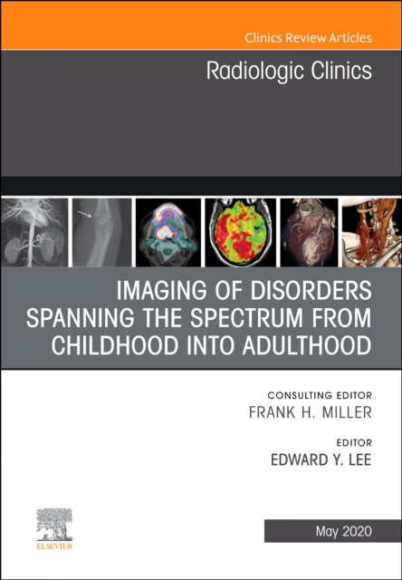 预订 imaging of disorders spanning the spectrum from *hood, an