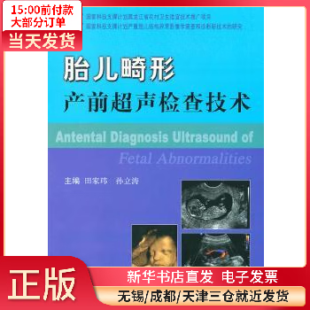 【正版包邮】 胎儿畸形产前超声检查技术 图书/医学/妇产科学 全新