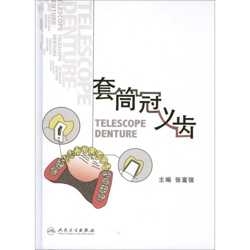 套筒冠义齿
