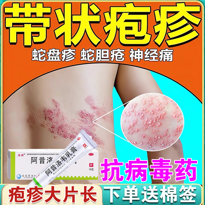 皮肤用药 1盒【汗疱疹】