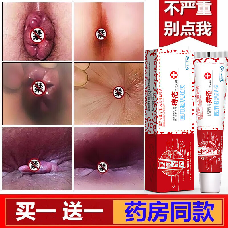 民間郎中華佗痔瘡膏凝膠去抑菌非肉球嚴(yán)重肛門瘙癢肛裂愈合膏外痔根膏斷非痔膏庤瘡痣瘡中草藥非孕婦可專用 【4盒】一周期