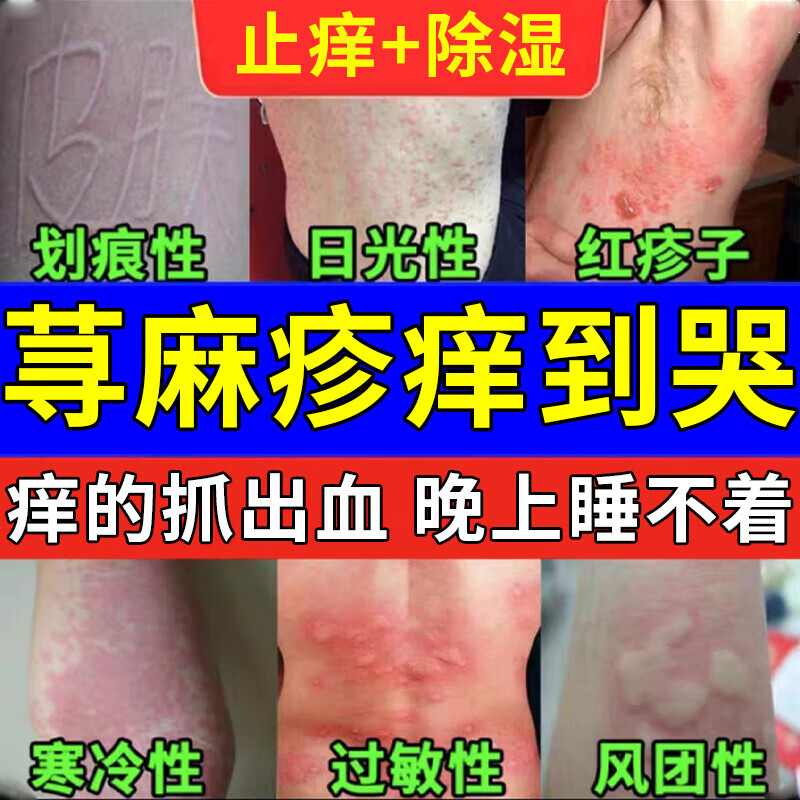 荨麻疹药过敏止痒皮肤用药非处方免疫力皮肤瘙痒中药增强时效荨麻疹丸