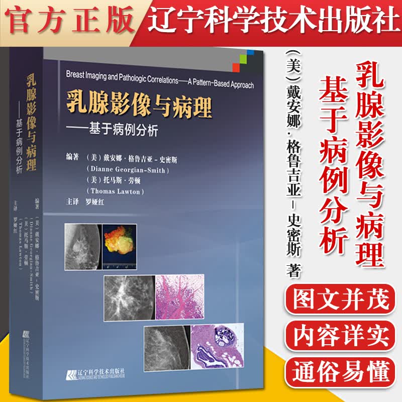 乳腺影像与病理 基于病例分析 美 戴安娜格鲁吉亚史密斯著 线超声图像乳腺乳腺影像诊断技术