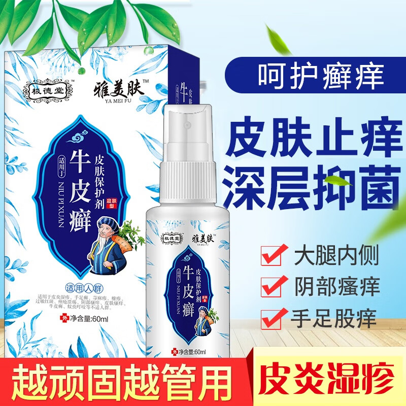 牛皮癣专用喷剂头皮痒脂溢性皮炎手足癣真菌感染喷剂荨麻红斑湿疹过敏